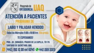 UAQ inicia Programa de Atención a pacientes con labio y paladar hendido