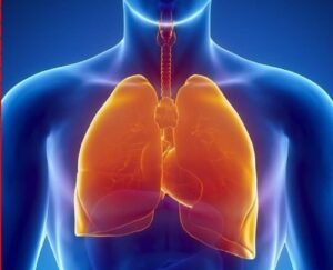 Conmemora SESEQ Día Mundial Contra el Cáncer de Pulmón